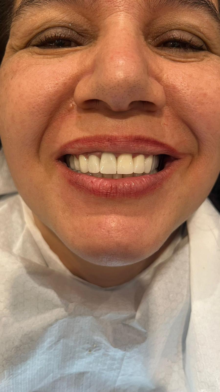 ECE Dental Patient Result